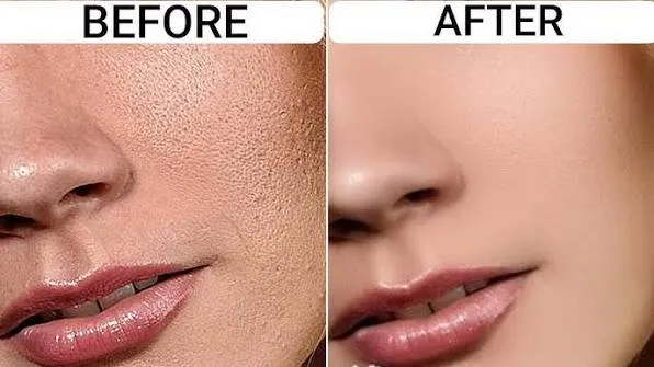 Smooth and soften rough skin.
