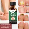 Fast Nail Fungus Treatment Serum thumbnail