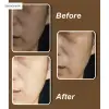Cheek and Chin Day & Night Brightening Cream thumbnail