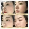 Chalonese Brightening Cream in Pakistan thumbnail