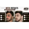 Niconi Men Enzyme De-Tan Pack For Face & Body thumbnail