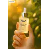 Fleure Anti Acne Serum thumbnail